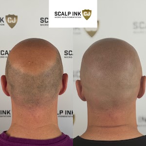 Scalp Ink CJ plaats foto