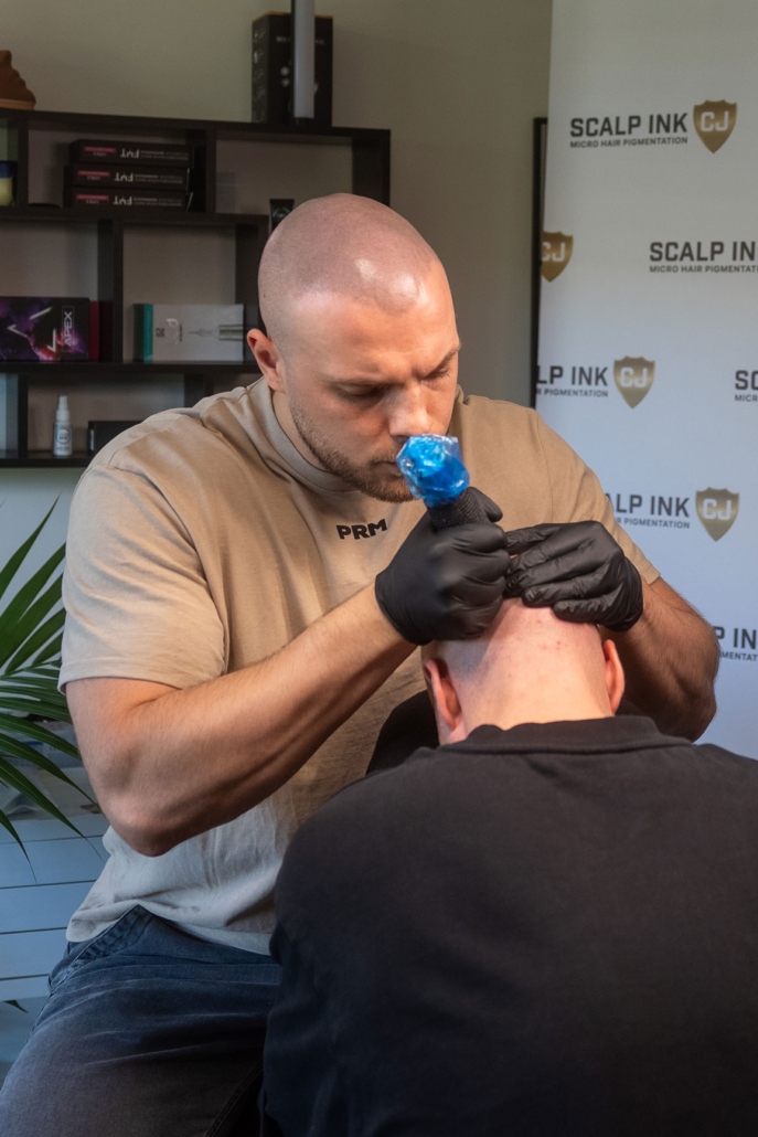 micro haar pigmentatie