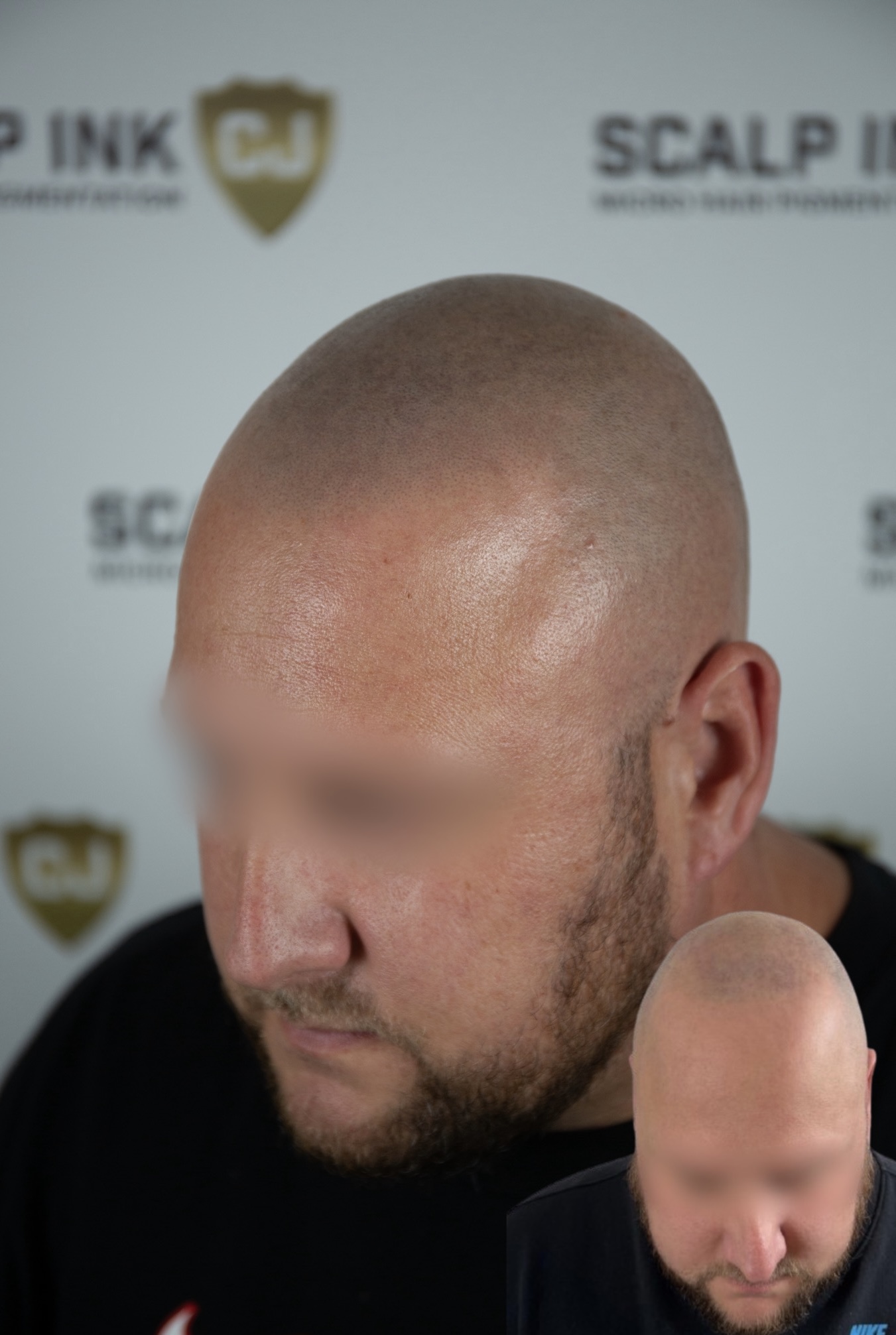 haar pigmentatie
