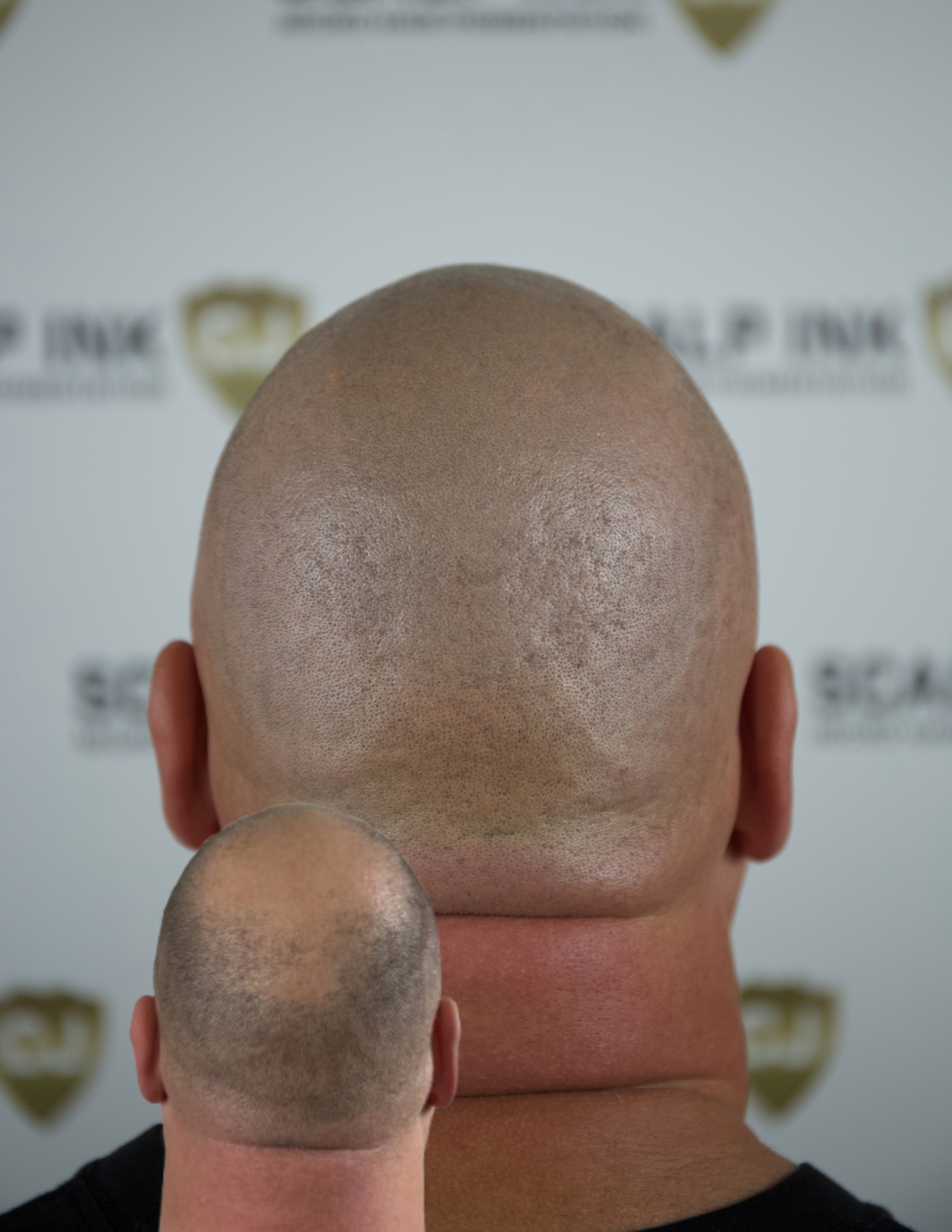 Resultaten die natuurlijk ogen